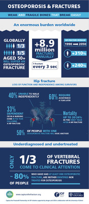 Despite its serious outcomes, osteoporosis remains vastly underdiagnosed and undertreated, particularly among individuals who have already broken a bone, and who are at high risk of suffering further fractures. The Capture the Fracture&reg; Partnership aims to proactively implement post-fracture care coordination programs in hospitals and healthcare systems, to help prevent subsequent fractures due to osteoporosis, and improve patient care.