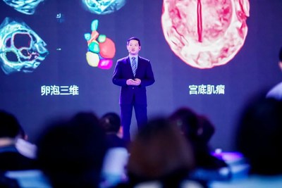 开立医疗临床经理谢剑锋先生介绍“凤影”